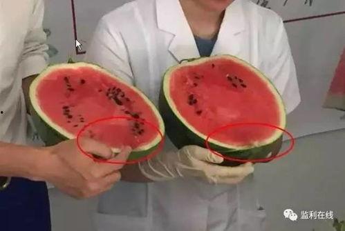 小孩吃瓜打针,小孩吃瓜打针的温馨瞬间